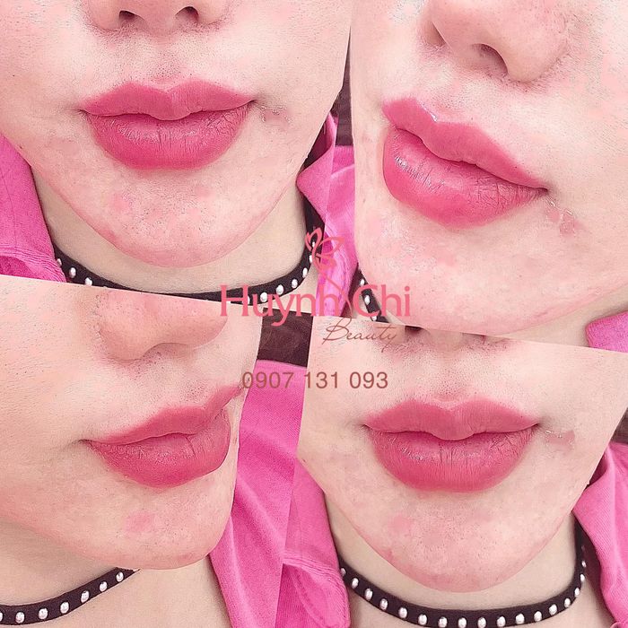 Hình ảnh Viện Thẩm Mỹ HUCI Beauty