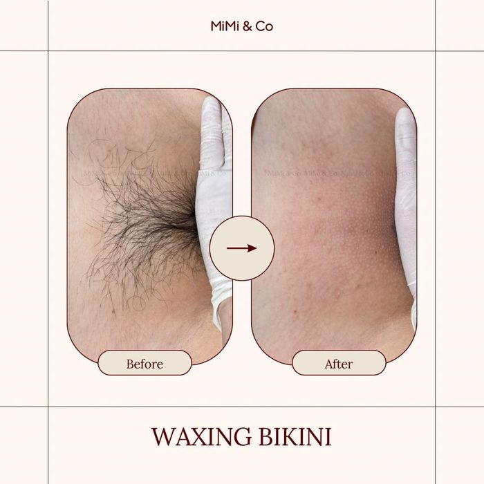 MiMi & Co Waxing - Hình ảnh dịch vụ waxing tại cơ sở, đảm bảo chất lượng và sự hài lòng của khách hàng