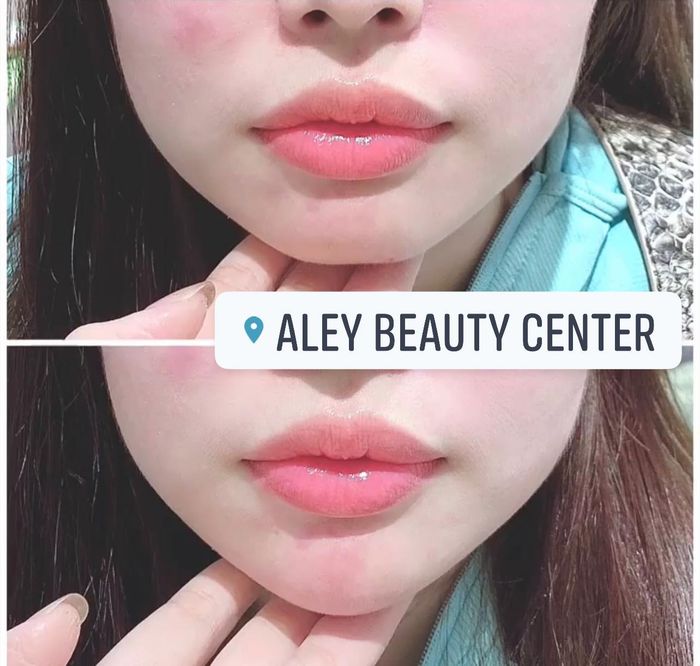 Hình ảnh Trung Tâm Thẩm Mỹ Aley Beauty