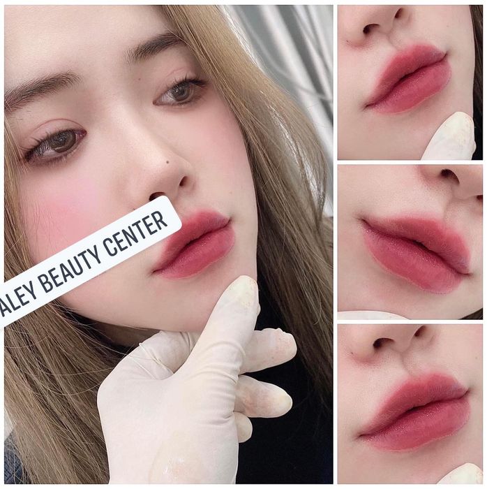 Hình ảnh Trung Tâm Thẩm Mỹ Aley Beauty 2