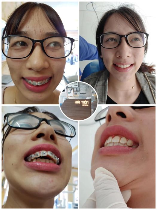 Hình ảnh đội ngũ bác sĩ chuyên nghiệp tại Nha Khoa Hải Tiền