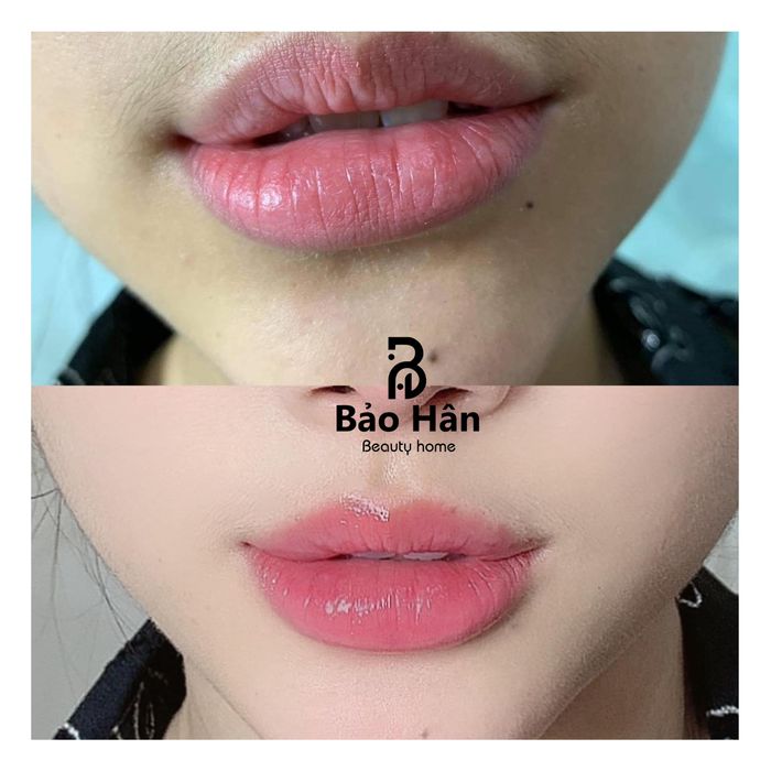 Hình ảnh Thẩm Mỹ Viện Bảo Hân 1