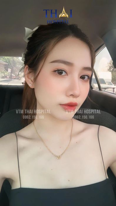 Hình ảnh 3