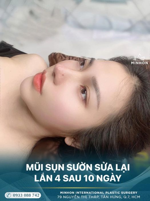 Viện Thẩm Mỹ Quốc Tế Minhon - Hình ảnh 2