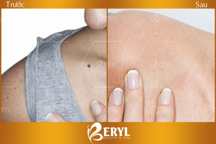 Không gian sang trọng chuẩn Châu Âu tại Beryl Beauty & Spa