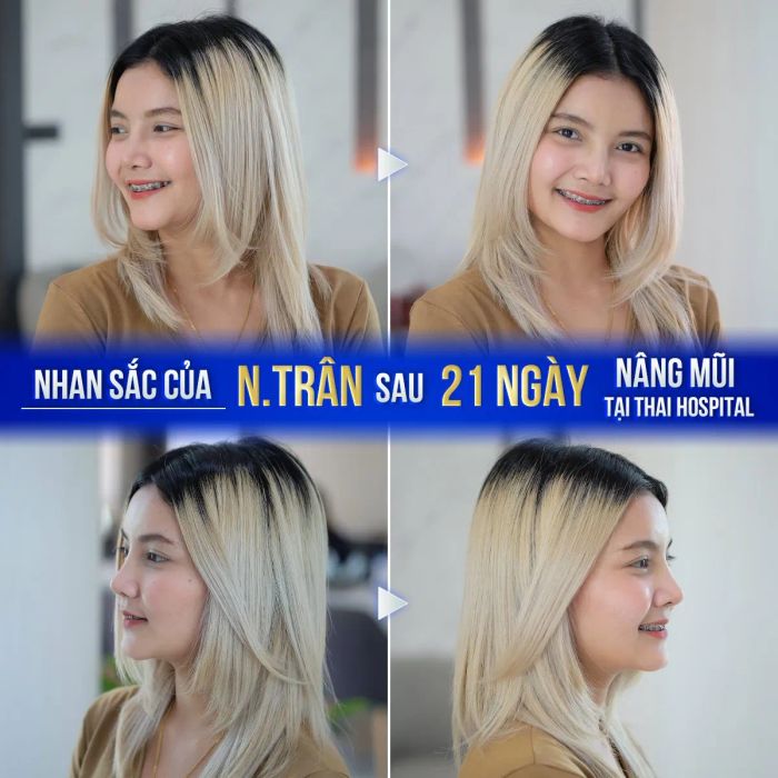 Viện Thẩm Mỹ Thai Hospital - Hình ảnh 2