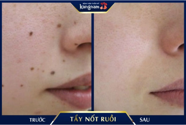Phòng điều trị cao cấp tại Bệnh Viện Thẩm Mỹ Kangnam