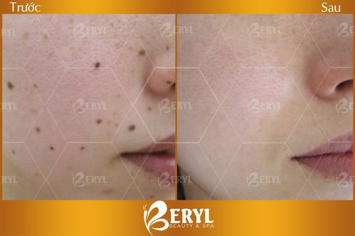 Phòng điều trị cao cấp tại Beryl Beauty & Spa