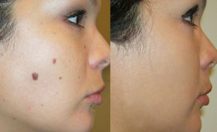 Phòng điều trị hiện đại tại Thẩm Mỹ Viện Seoul Spa