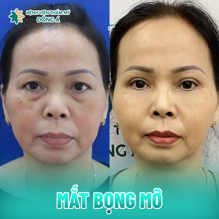 Cơ sở vật chất hiện đại tại Bệnh Viện Thẩm Mỹ Đông Á