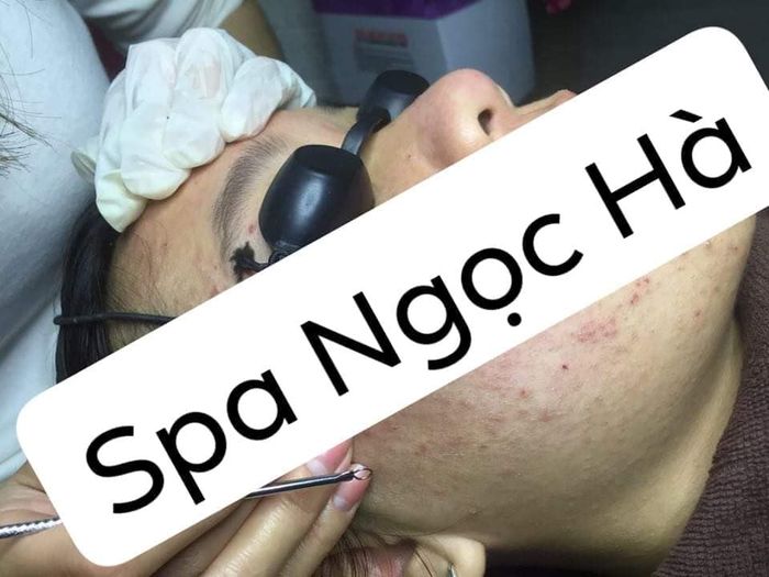 Quy trình trị mụn chuyên nghiệp tại Ngọc Hà Spa