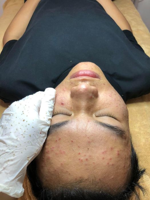 Không gian trị liệu cao cấp tại Tâm Anh Spa