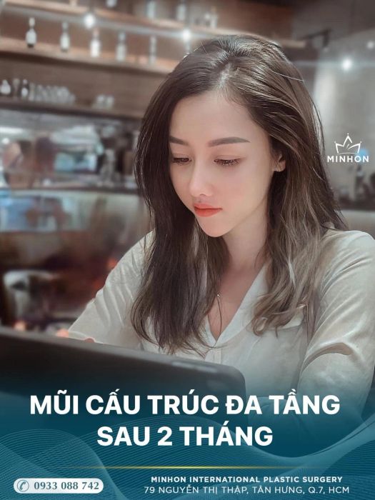 Viện Thẩm Mỹ Quốc Tế Minhon - Hình ảnh 1