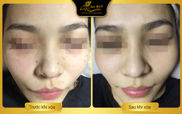 Không gian sang trọng tại H&T Beauty Center