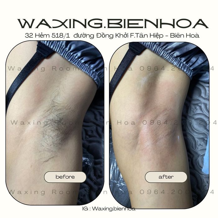 Hình ảnh quy trình waxing chuyên nghiệp tại Amy Waxing Room