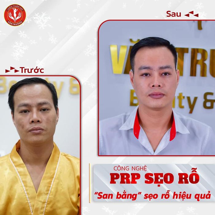 Hình ảnh quy trình điều trị chuyên nghiệp tại Viện Thẩm Mỹ Văn Trường