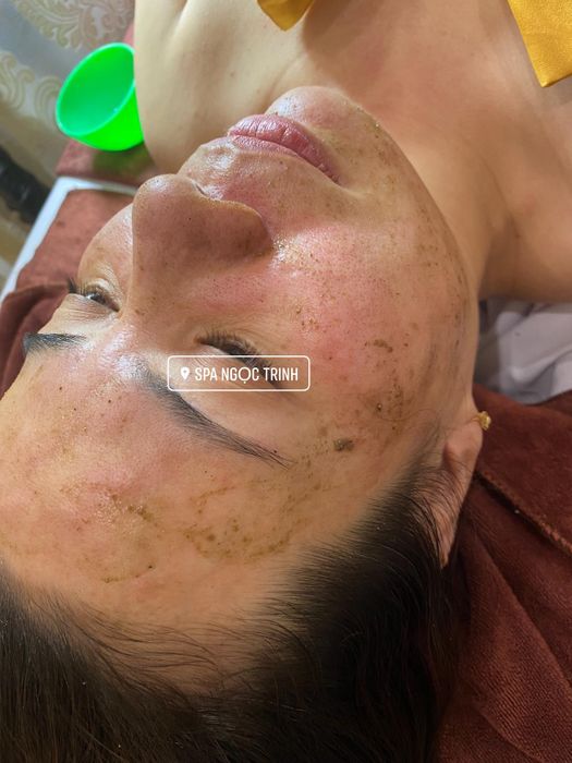 Hình ảnh quy trình trị liệu chuyên nghiệp tại Spa Ngọc Trinh