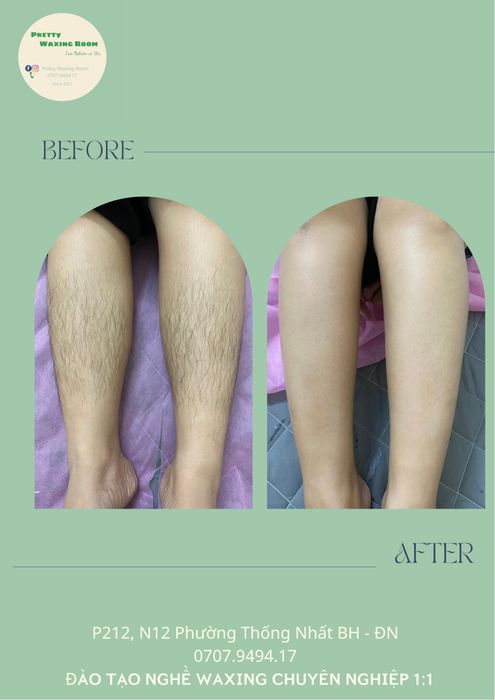 Hình ảnh quy trình waxing chuyên nghiệp tại Pretty.WaxingRoom
