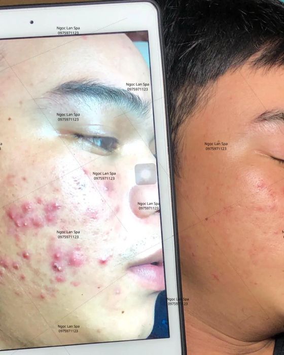 Không gian điều trị hiện đại tại Ngọc Lan Spa