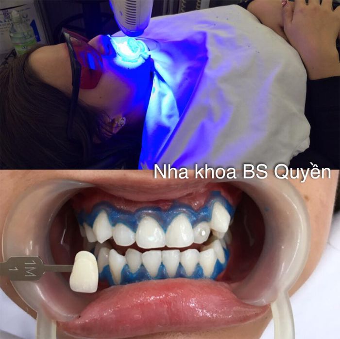 Nha Khoa Bác Sĩ Quyền - Hình ảnh 2