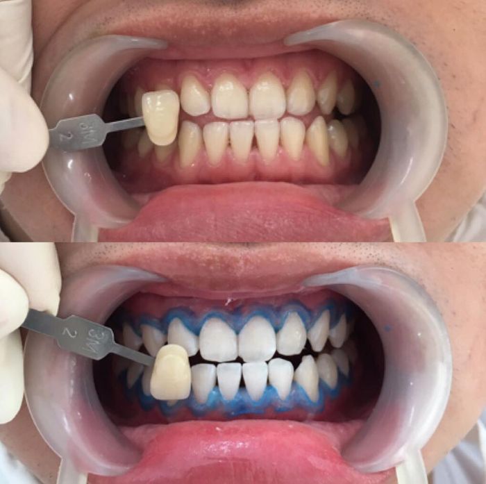 Nha Khoa Bác Sĩ Quyền - Hình ảnh 1