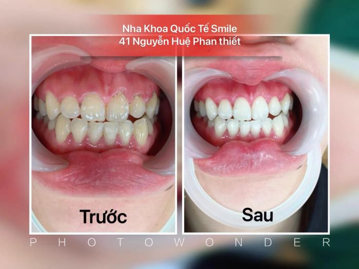 Khám phá không gian hiện đại và cơ sở vật chất đạt chuẩn quốc tế tại NHA KHOA QUỐC TẾ SMILE qua hình ảnh 1