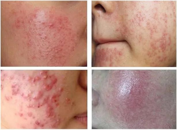 Mộc Home Spa ảnh 2 - Không gian trị liệu đậm chất thiền định