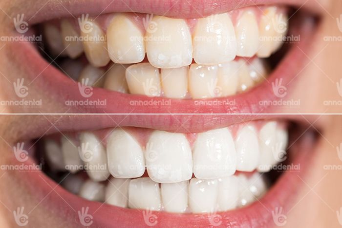 Không gian hiện đại tại Nha Khoa Anna