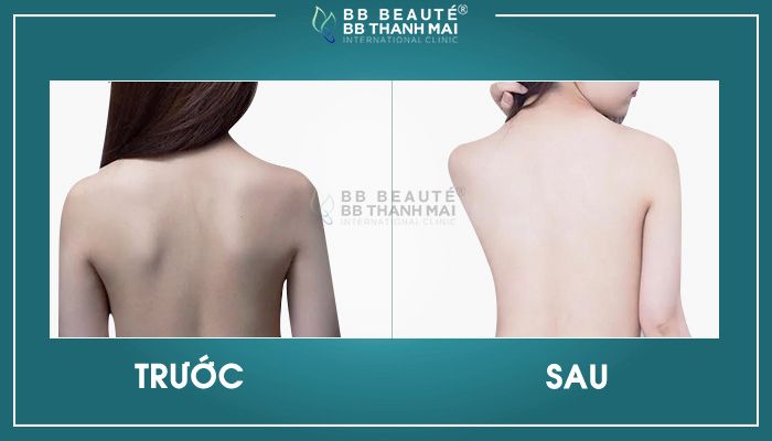 BB Beauté – BB Thanh Mai - Ảnh minh họa 2