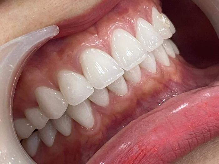 Khám phá không gian hiện đại tại Phòng Khám Nha Khoa Việt Đức - Cao Bằng qua loạt ảnh chất lượng cao