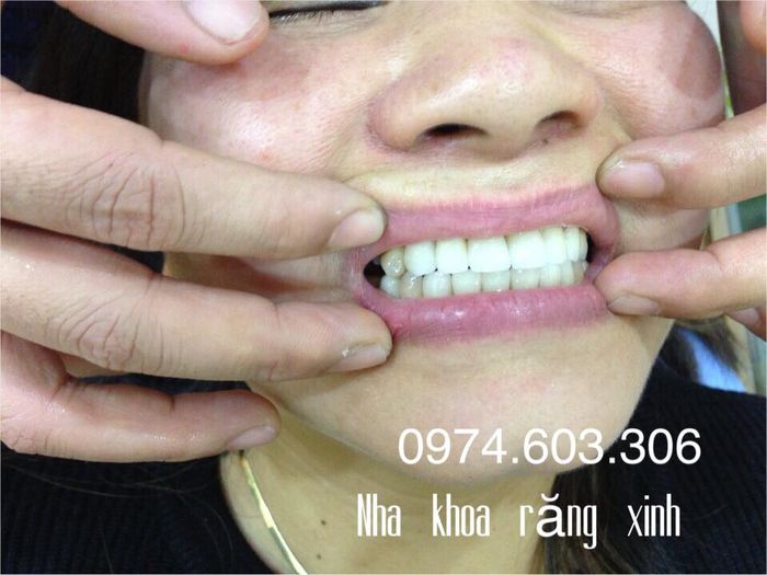 Khám phá không gian hiện đại và dịch vụ chất lượng tại Nha khoa Răng Xinh - Cao Bằng qua loạt ảnh độc quyền