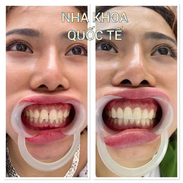 Hình ảnh thực tế Nha Khoa Quốc Tế - Sài Gòn