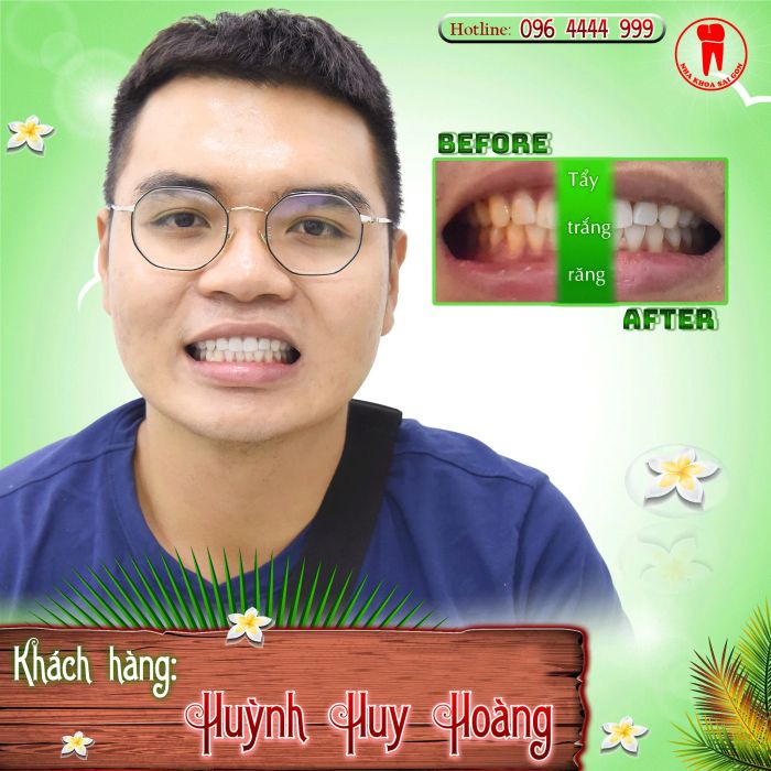 Hình ảnh cơ sở vật chất hiện đại tại Nha Khoa Sài Gòn - Phan Thiết