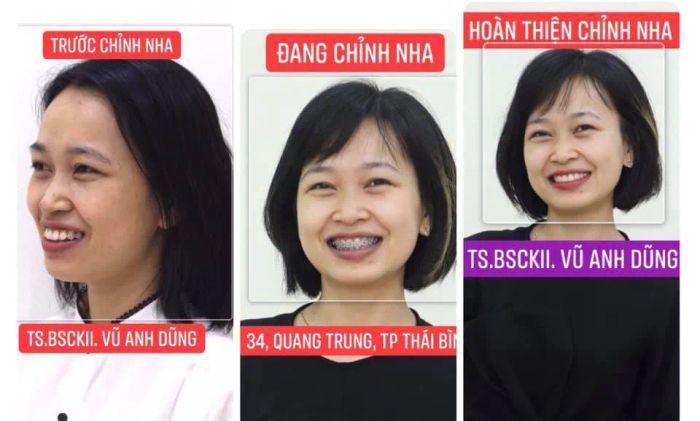 Trung tâm Nha khoa & Thẩm mỹ Anh Dũng – Ảnh 2