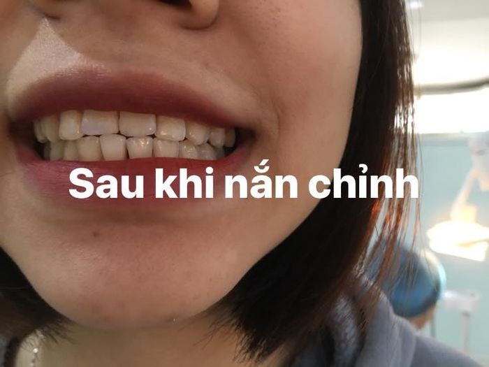 Nha Khoa Tuyết Mai Hà Nội - Hình ảnh 2