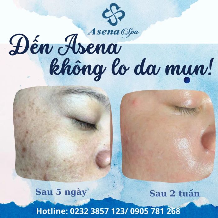 Không gian trị liệu sang trọng tại Asena Spa