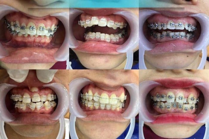 Nha Khoa Tuyết Mai Hà Nội - Hình ảnh 1