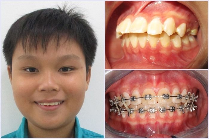 NHA KHOA KHÁNH NHƯ - Hình ảnh 2