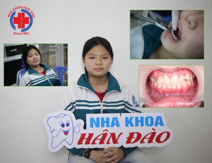 Nha Khoa Hân Đào Thái Bình ảnh 1