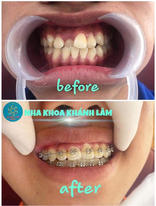 Nha Khoa Khánh Lâm - Hình ảnh 2