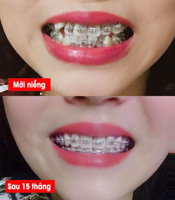 Nha Khoa Khánh Như - Hình ảnh 1
