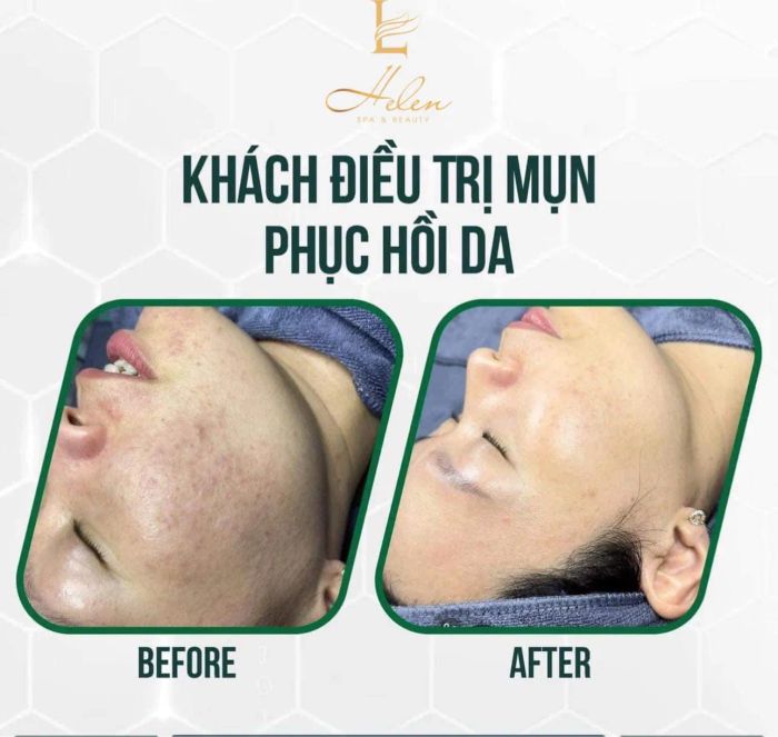 Không gian sang trọng và hiện đại tại Helen Spa & Beauty