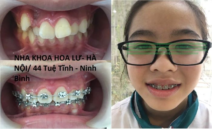 Hệ thống phòng khám tiêu chuẩn tại Nha Khoa Hoa Lư