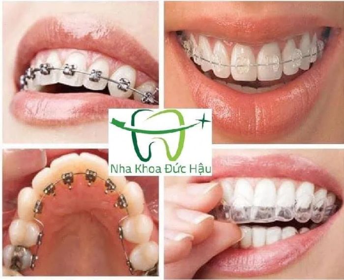 NHA KHOA ĐỨC HẬU ảnh 2