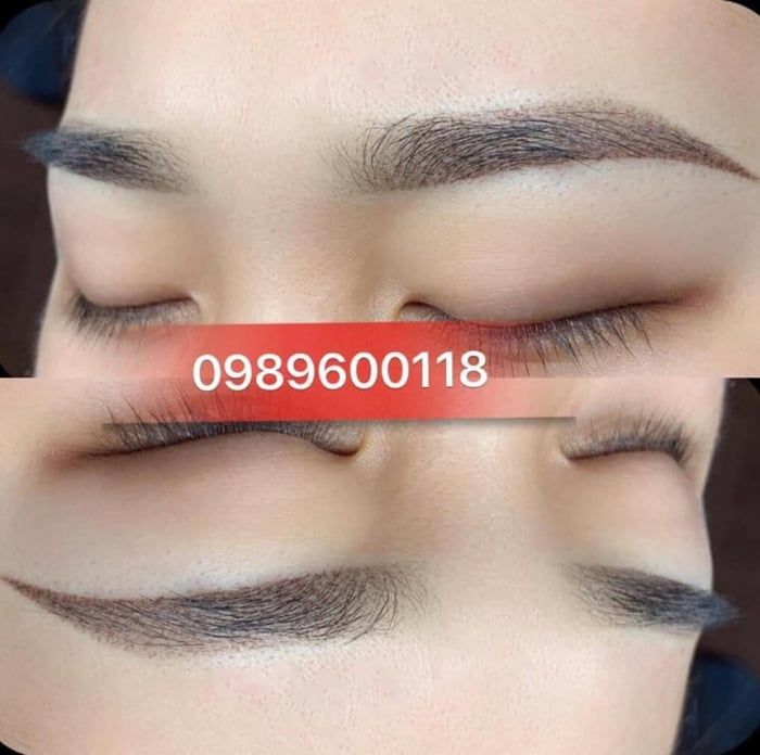 Viện Thẩm Mỹ Nhung Nhung - Hình ảnh