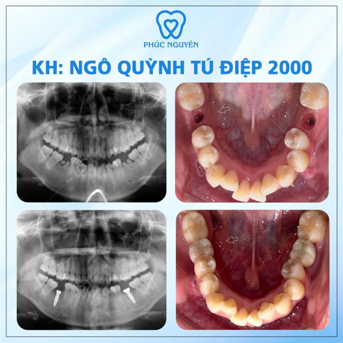 Hình ảnh đội ngũ bác sĩ chuyên gia tại Nha Khoa Phúc Nguyên
