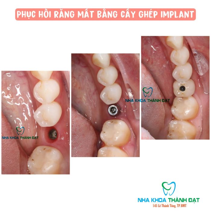 Hình ảnh đội ngũ bác sĩ chuyên gia tại Nha Khoa Thành Đạt
