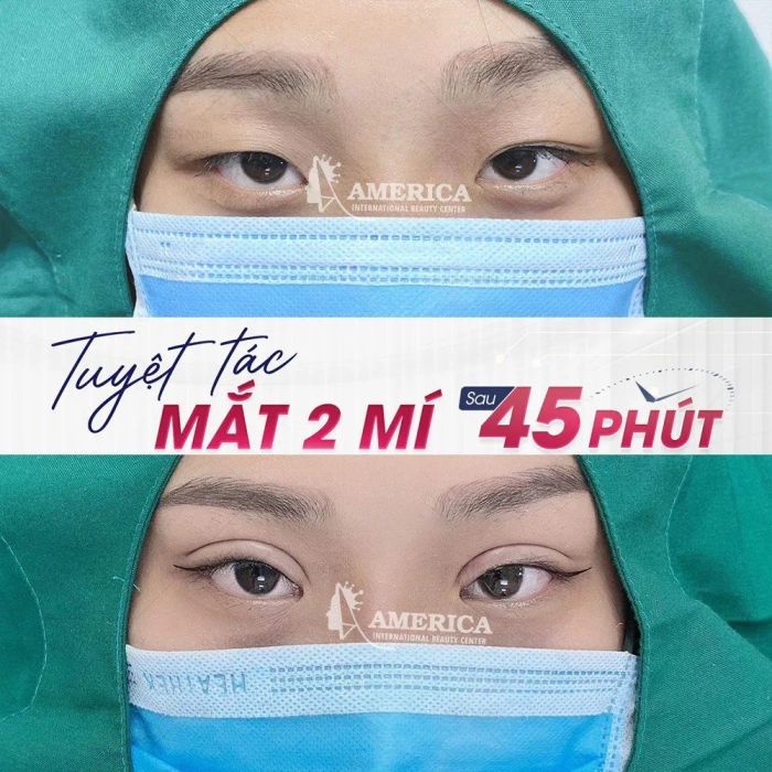 Không gian sang trọng tại Thẩm mỹ viện America