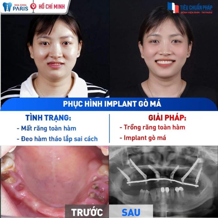 Hình ảnh thực tế về cơ sở vật chất hiện đại tại Nha Khoa Paris Buôn Ma Thuột