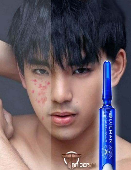 Hình ảnh sản phẩm Serum BlueMan cho nam giới